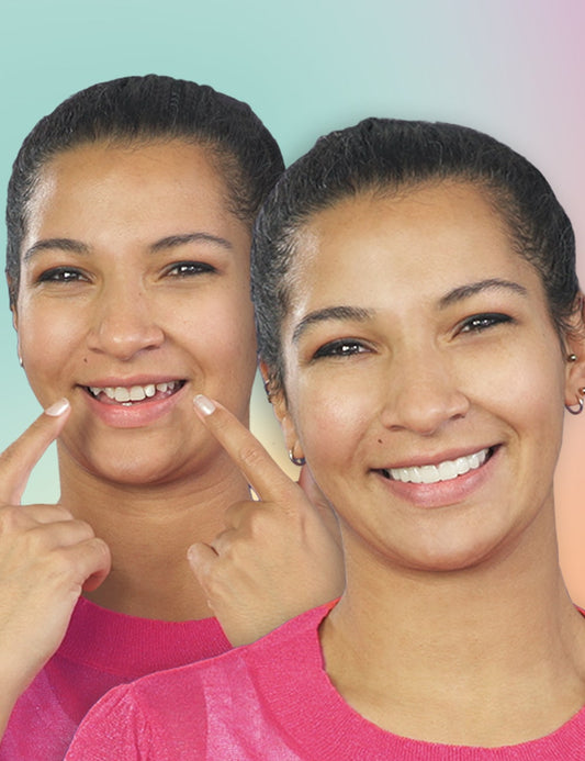 Teeth-Veneer 2.0