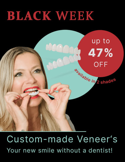 Teeth-Veneer 2.0