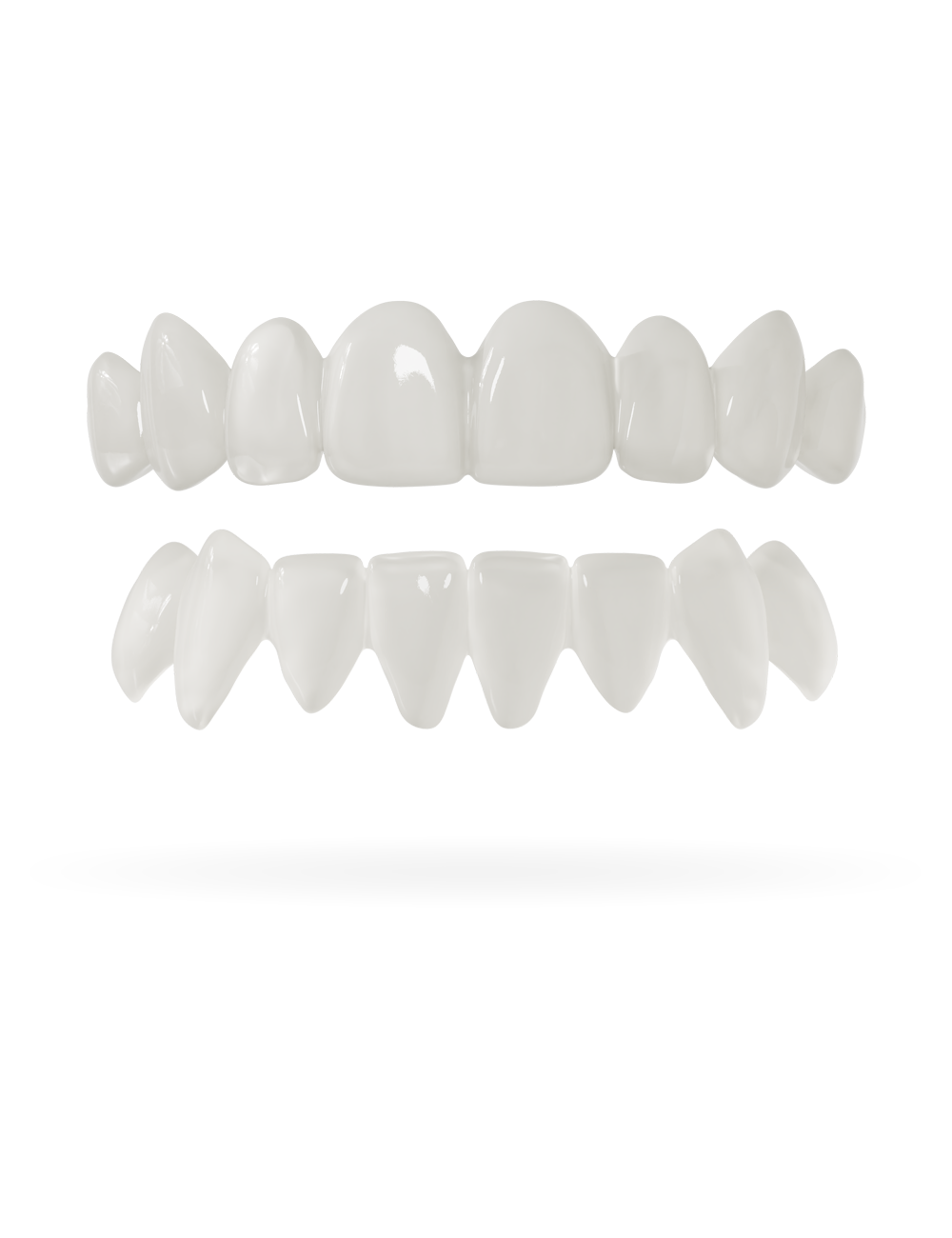 Teeth-Veneer top and bottom nature
