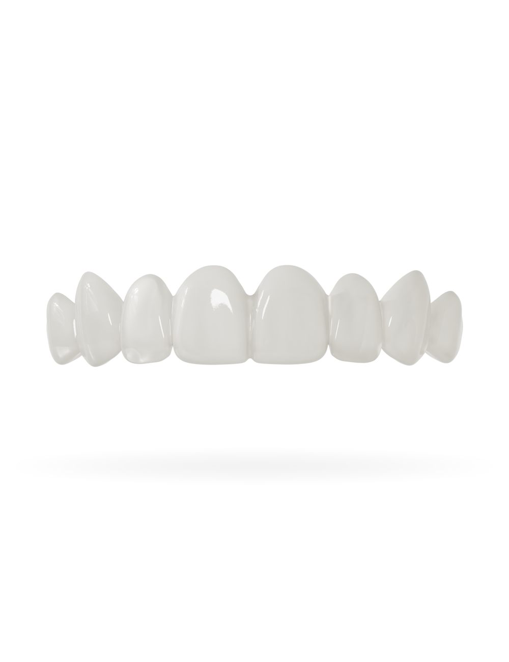 Teeth-Veneer upper jaw_nature