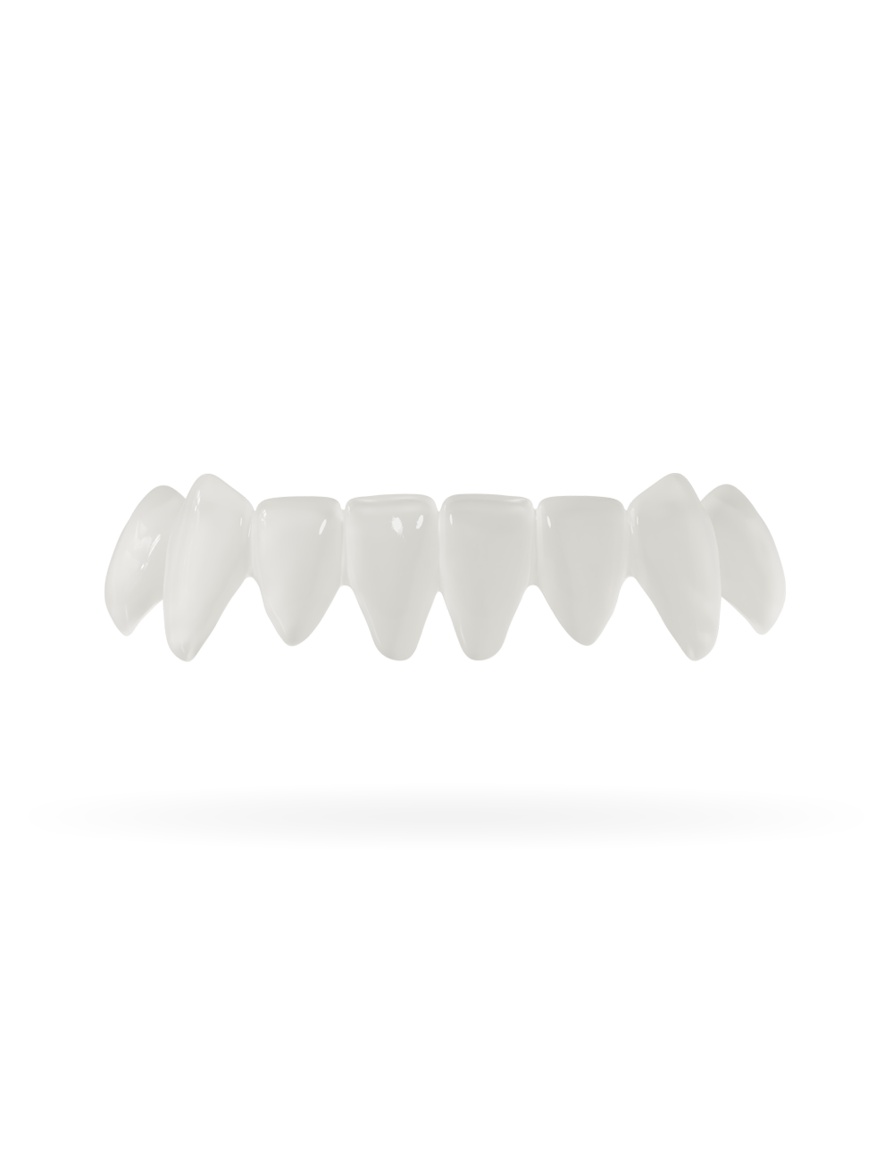 Veneera veneer lower jaw